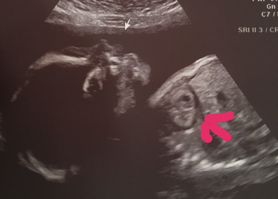 3f8697867a863e8a18c6d1426c391403